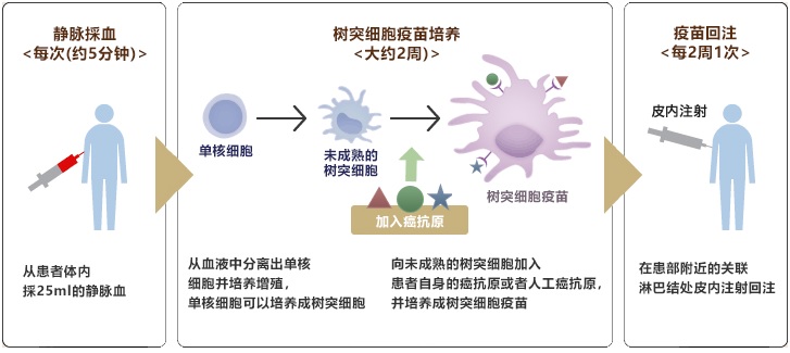 樹(shù)突細(xì)胞疫苗療法的流程